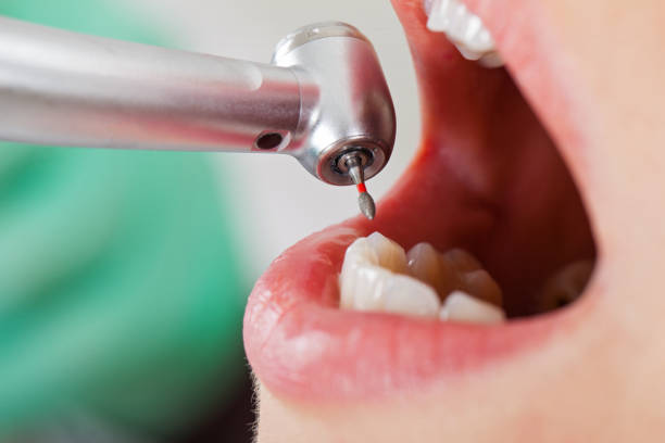 Best Urgent Dental Care for Toothache in Freeman, SD